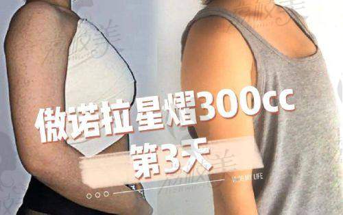 三、武汉同济医学院医院黄立、唐泓波、曾宁医生：专精的手术建议提供者
