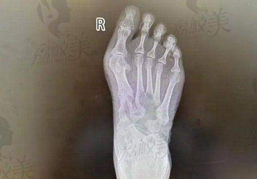 项目介绍