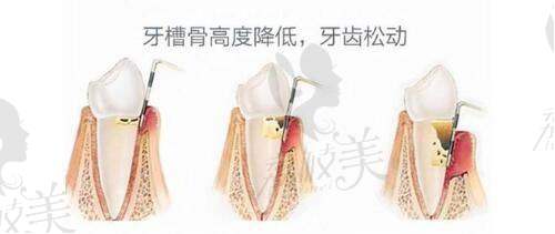 三、哪些人适合郑州王杨医生的眼袋修复与卧蚕塑造项目？