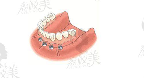 三、好在哪？植是道的三大设计亮点