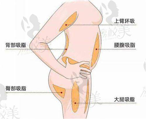 沈阳华美植发医院张浩医生微创腋臭手术价格5800元起，创伤小恢复快