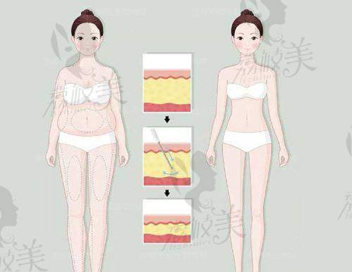 杭州薇琳医院配套服务