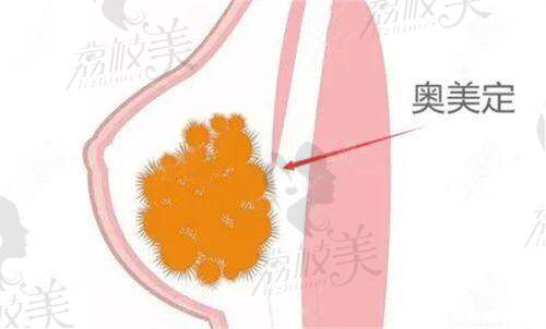 价格情况：杭州艺星李俊霞医生透明合理的价格体系