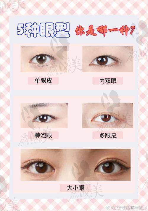 长沙雅美王少甫医生美杜莎6.0双眼皮超自然，1万5收获妈生款电眼魅力值拉满