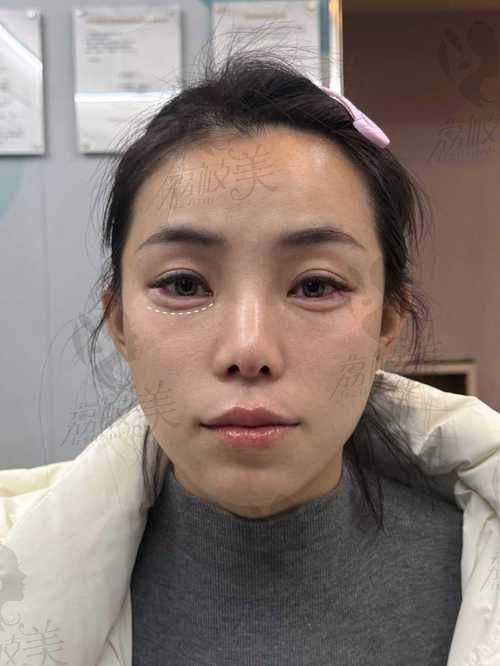 重庆打卧蚕理性消费，重视专精
