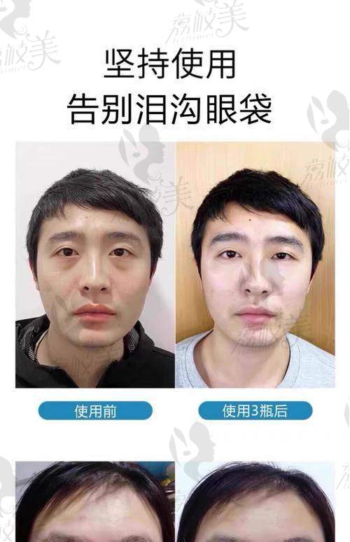 手术前