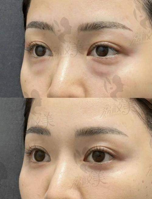 吕建华医生技术优势大揭秘