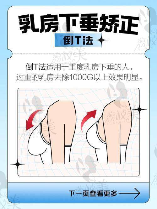 长沙雅美王晓朋做缩胸手术效果绝绝子，3万8即刻拥有小胸轻盈自信飙升