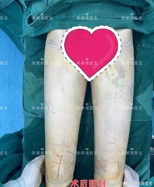四、价格套餐大公开：懒人专属直接抄作业！