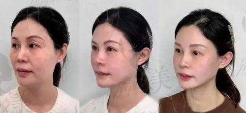 杭州：杭州时光医疗美容医院