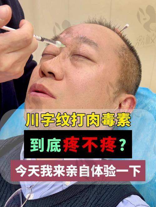 李广学医生：拉皮手术治疗额头川字纹的有效途径