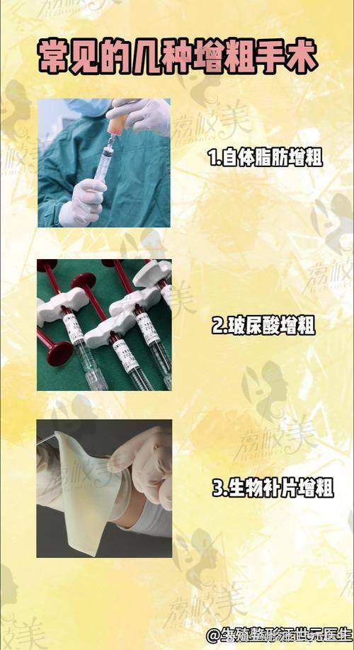 李世荣阴茎增粗延长手术核心优势