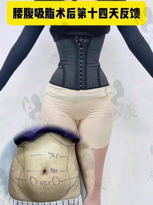 总结