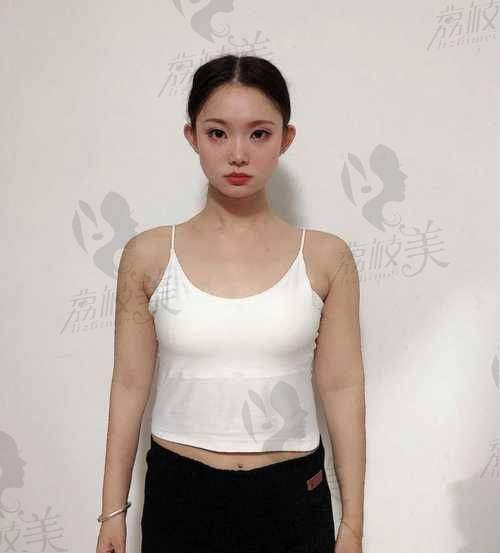 重庆军科整形医院腰腹环吸价格详情