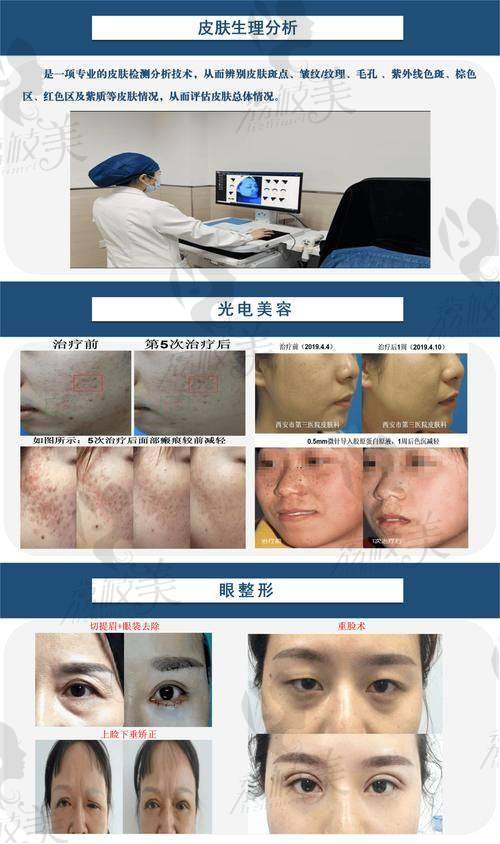 医院ONDA价格套路分析，别掉坑！