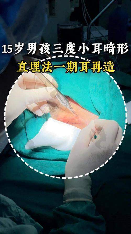 七、术后护理与随访体系：不只是做一个耳朵，更是一场修复之旅