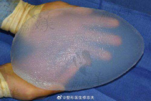 深圳福雅范开防假体丰臀：口碑爆棚