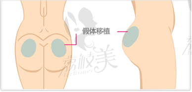 抓住机会，开启你的美臀之旅