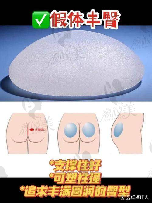 真人实例：69800 元起的美臀蜕变