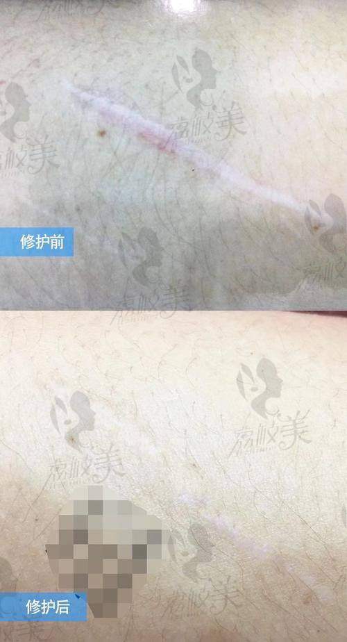 成都军建医院正规资质，医德医风有保护