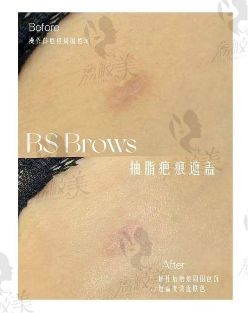 患者口碑真实好评，来自亲身治疗经验分享