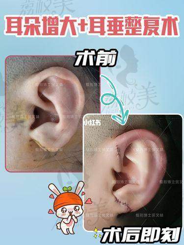 谁适合找吴建明医生？看这几个条件你对上了吗