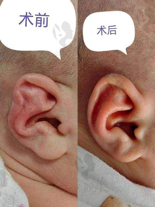 预约方式全整理！要省心也要认准渠道