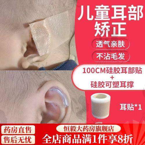 关键来了：吴建明耳再造手术多少钱？报销完大约花多少？