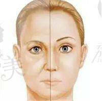 项目介绍