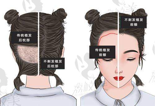 项目价格表