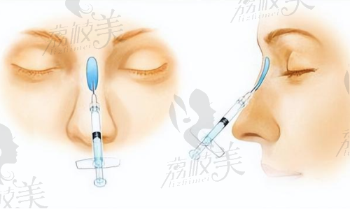 鼻部精细化雕刻