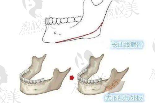 三、项目介绍