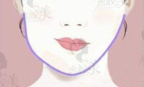 面部年轻化项目
