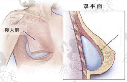 三、项目介绍