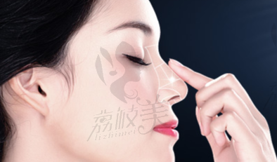 南昌阅美医疗美容吕建华做肋软骨鼻综合33800元起，精细塑鼻打造自然美鼻效果