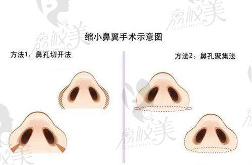 四、项目价格表