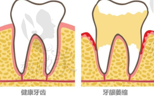 朝阳牙博士口腔医院是正规的吗？当地老百姓评价牙博士是性价比高的靠谱之选