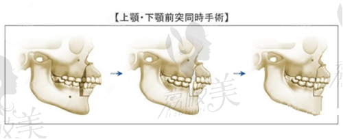 项目价格表