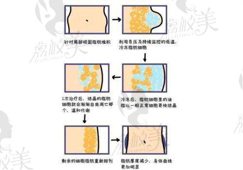 四、项目价格表