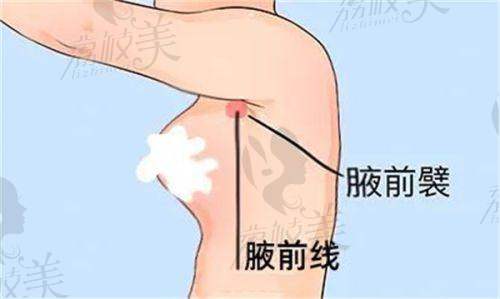 杨健医生怎么预约挂号？