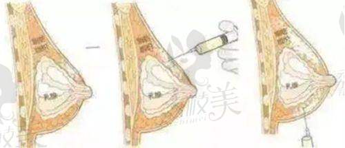 三、谷亦涵医生特色项目介绍