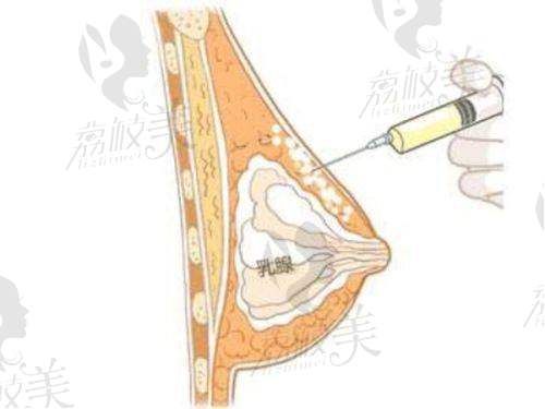 项目价格表