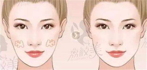 (一)高难度眼修复