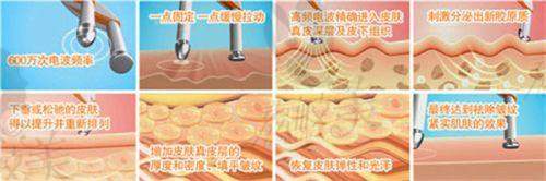 北京画美医院张守玲医生眼部精雕2980元起——动态美学之选