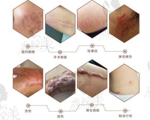 徐学东医生擅长项目介绍