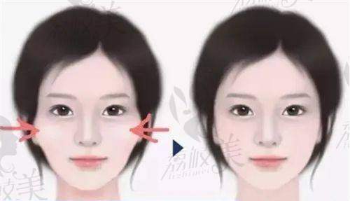 北京画美医院张蔚萱医生女性私密健康治疗3800元起——身心同治显优势