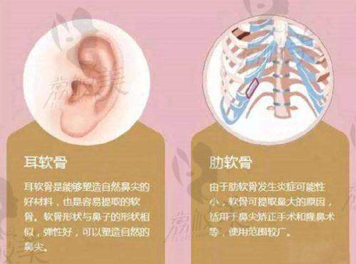 项目介绍