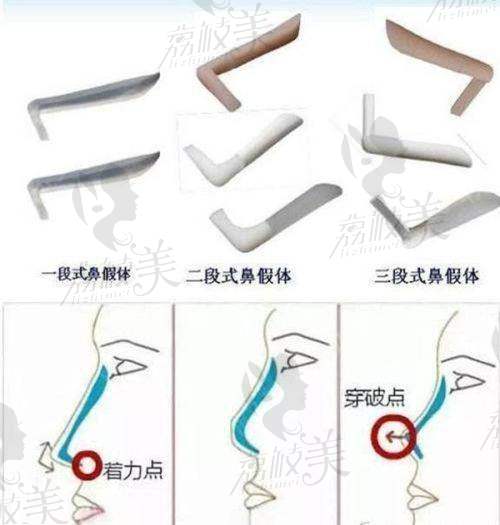 惠州哪家公立整形医院好？市六医院、市一医院口碑实力双优推荐！