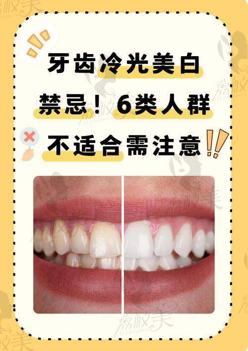 泉州美特尔口腔皓齿美白收费价格仅980元｜轻松Get明星级笑容，告别黄板牙烦恼