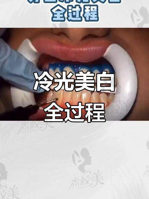 泉州美特尔口腔简介：连锁实力，安心之选